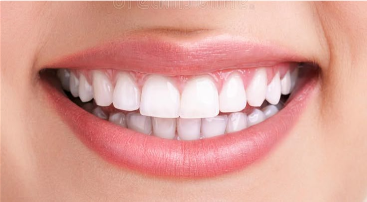 Before whitening treatment
